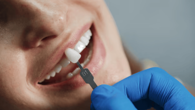 انواع روکش دندان : بررسی تخصصی و کاربردی